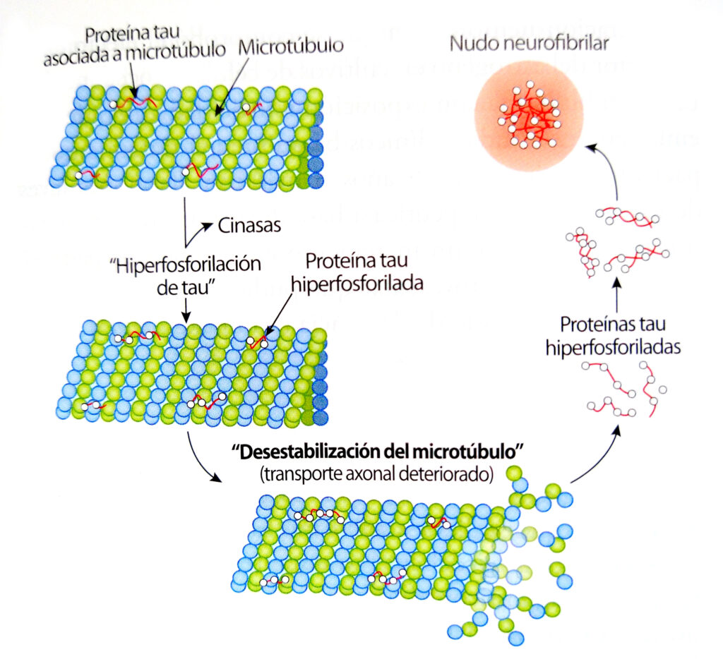 microtubulos y proteina tau